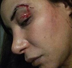 Maroc Loubna Abidar agressée